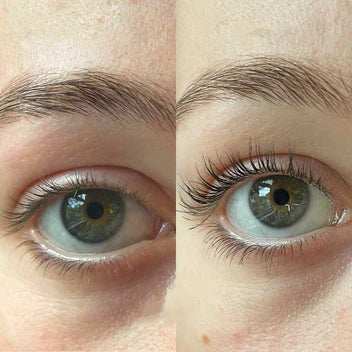 Nourish eyelashes™ | Holen Sie sich die schönsten natürlichen Wimpern!  1+1 FREI!