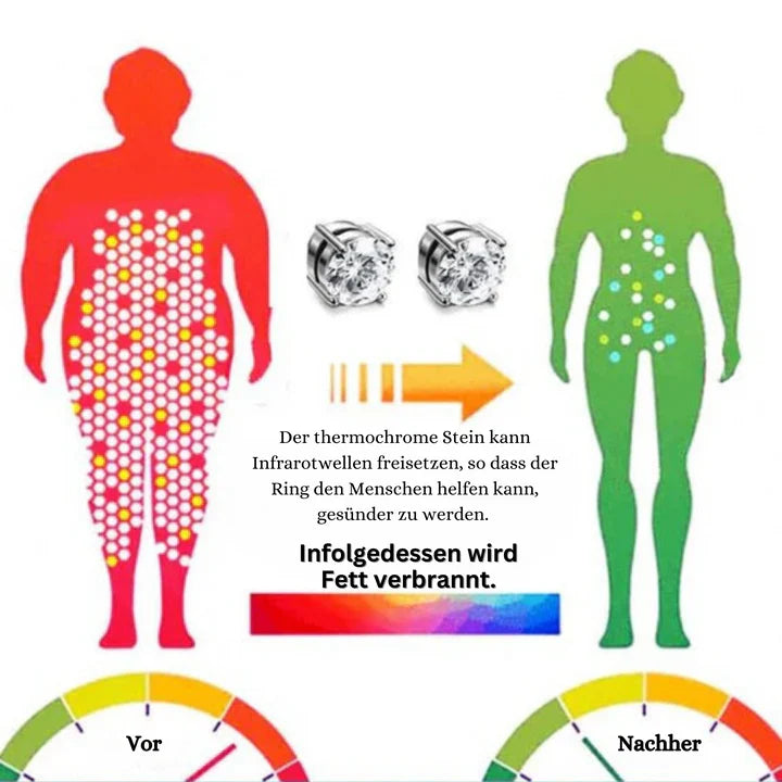 TheraRings™ - Magnetische Therapie-Ohrringe für Schmerzlinderung