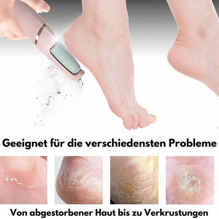 50% Rabatt | FeetCare™ - Hornhautentferner