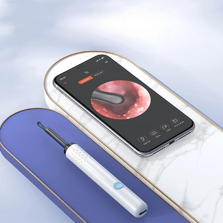 HealthView™ – Präzises Endoskop zur sicheren Ohrenschmalz-Entfernung