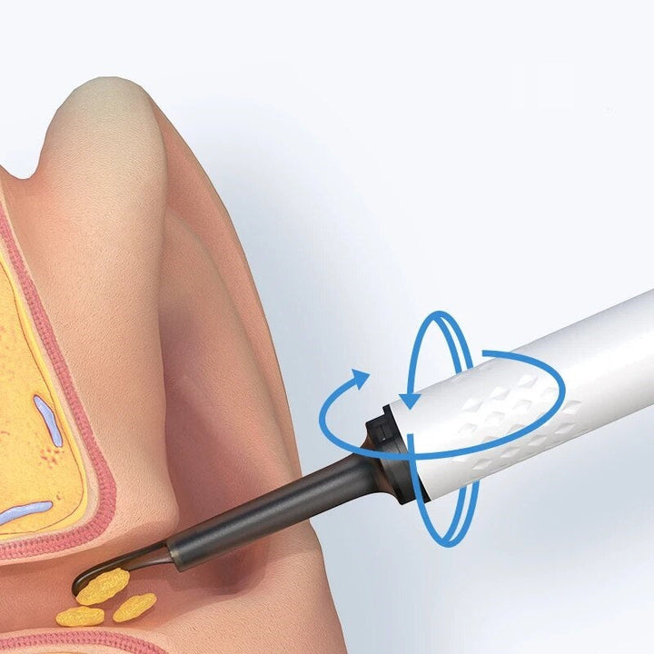 HealthView™ – Präzises Endoskop zur sicheren Ohrenschmalz-Entfernung