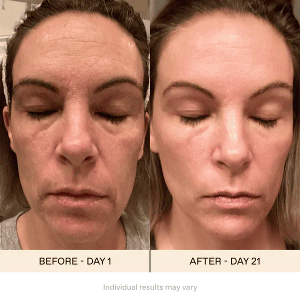 EyeRevive™ – Das Revolutionäre Gerät zur Augenrevitalisierung