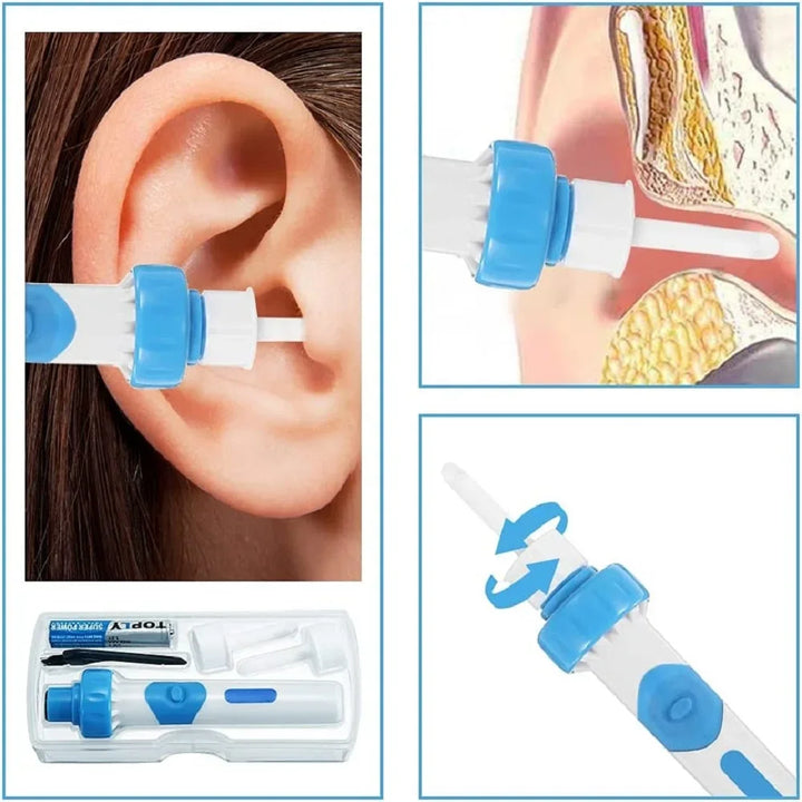 50% RABATT | EarSonic™ - Tragbarer Ohrenschmalz-Staubsauger [Letzter Tag Rabatt]
