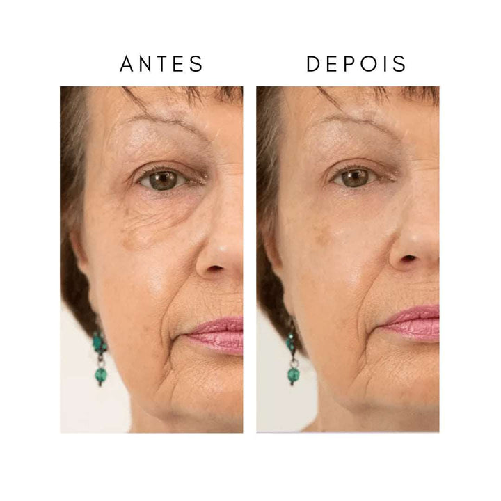 Anti-Aging-Creme (1+1 Gratis)