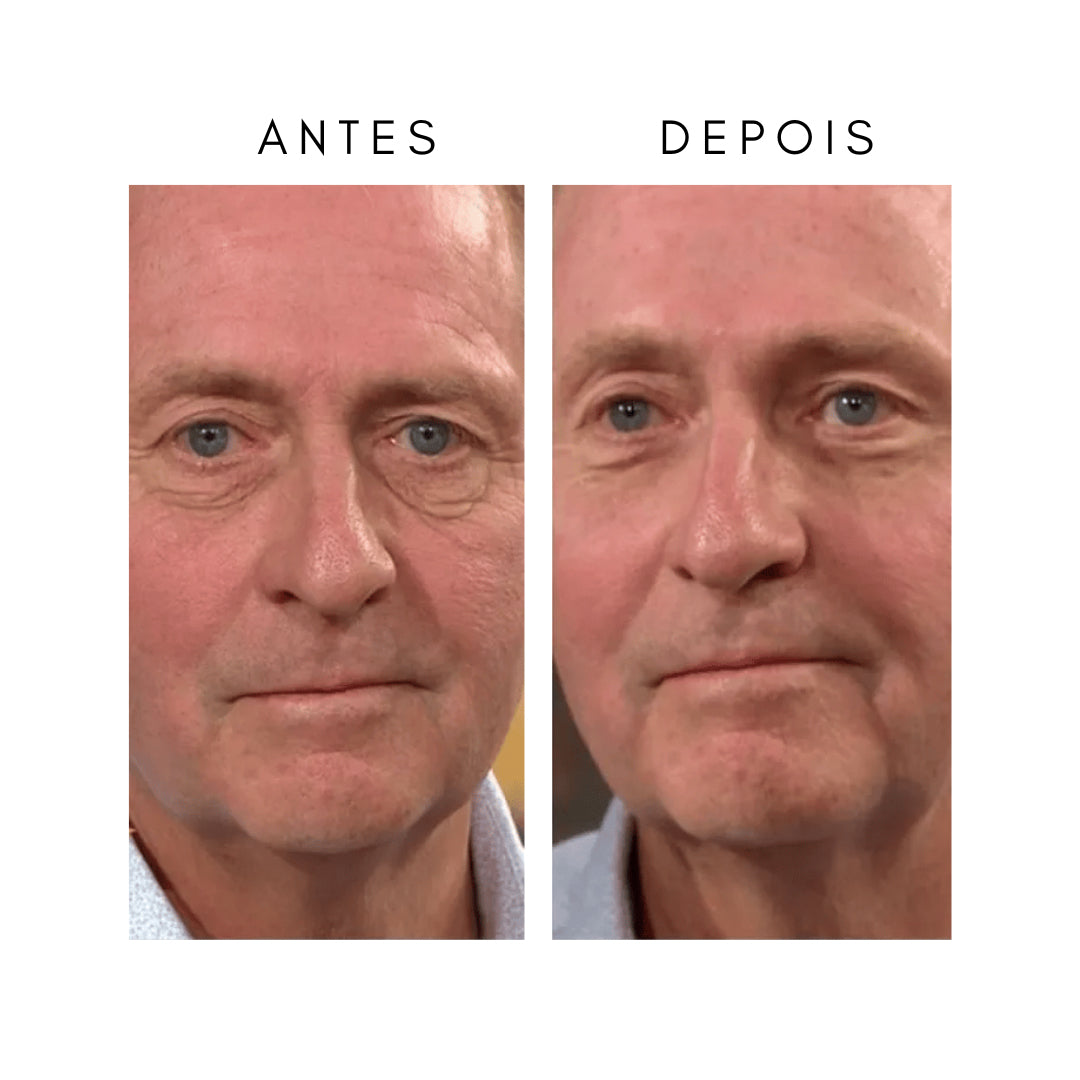 Anti-Aging-Creme (1+1 Gratis)