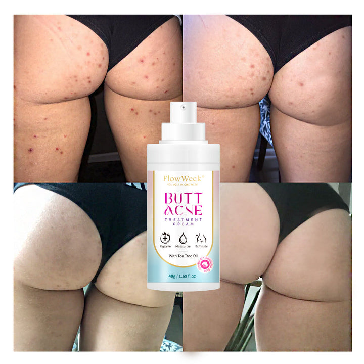 ClearDerma™ Butt Akne Spot Behandlung