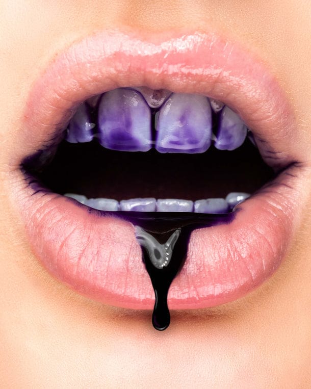 BeautySmile™  genießen Sie ein strahlend weißes Lächeln ohne Risiko!